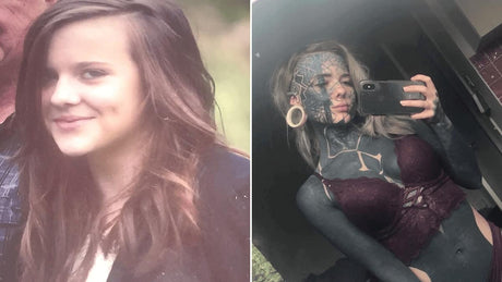 before-and-after